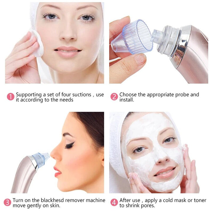 Multifunctional Beauty Pore Vacuum 4 in 1